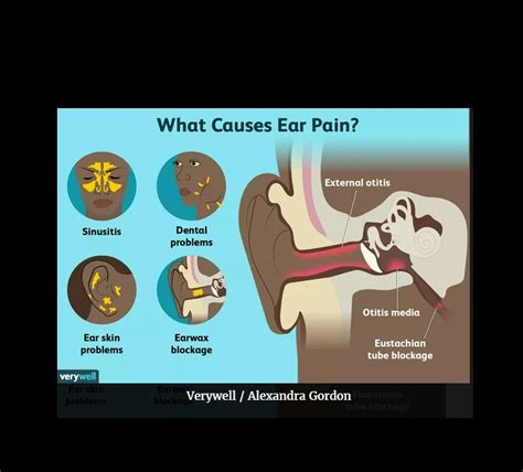 Causes of Ear Pain and Treatment Options - FrontlineER Dallas