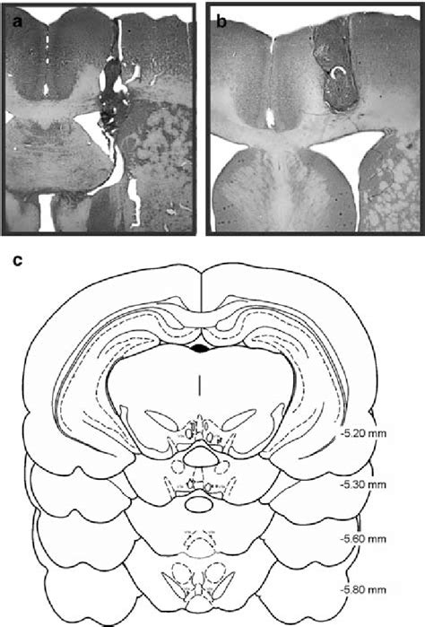 Histology. (a) Accurate unilateral lateral ventricle (ICV) cannula ...