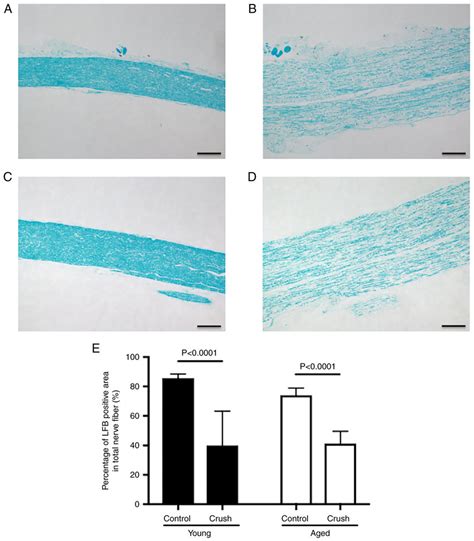 Histochemical assessment of the degree of Wallerian degeneration in the ...