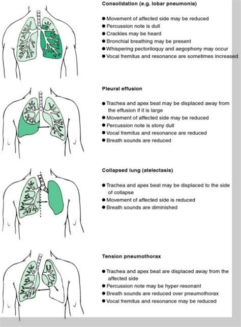 Signs Lung Disease - Physical Exam | EMS Study Material | Pinterest