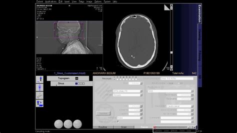 CT Scan of PNS Technic full process - YouTube