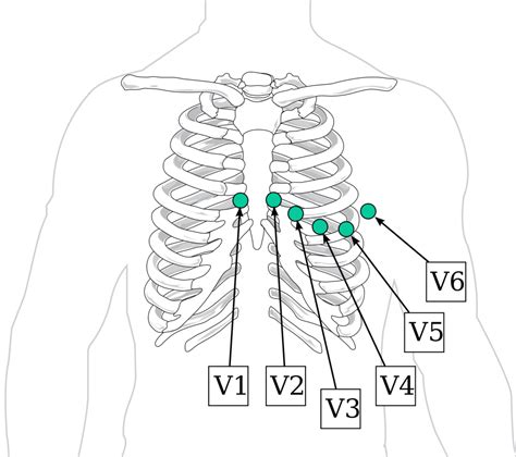 Electrocardiogram Guide (EKG/ECG) - Stepwards