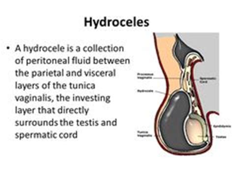 99 ideas de ECOGRAFÍA ESCROTAL | ultrasonido, radiología, imagenología