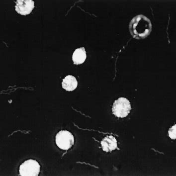 Spirochete-like cells in blood cultures as seen by dark- fi eld ...