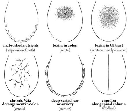 Tongue Diagnosis Chart Chinese Ayurveda Analyses | Hot Sex Picture