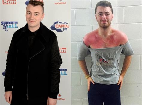 Sam Smith Weight Loss Then And Now