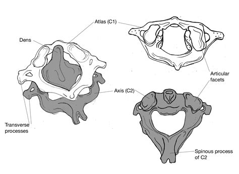 Atlas: first cervical vertebra; holds up the skull and articulates with the occipital bone ...