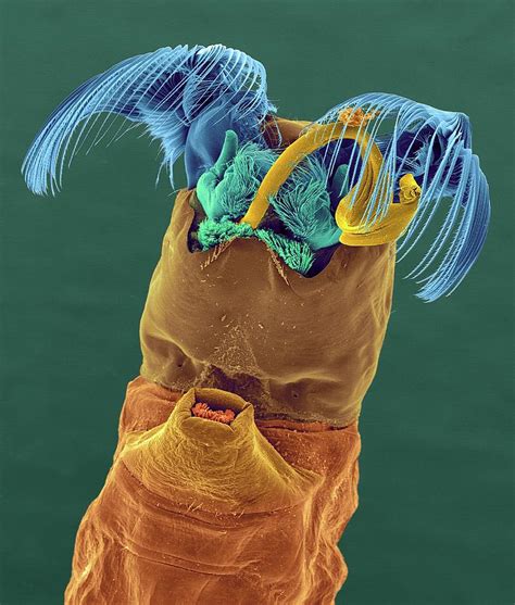 Black Fly Larva Photograph by Dennis Kunkel Microscopy/science Photo ...