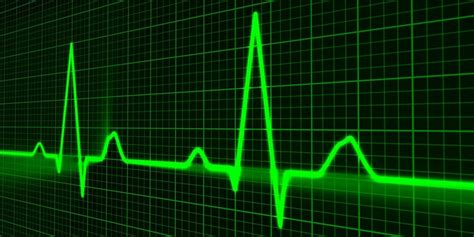 Electrocardiogram: Blog chronicles value of old, but still vital cardiac test - Scope