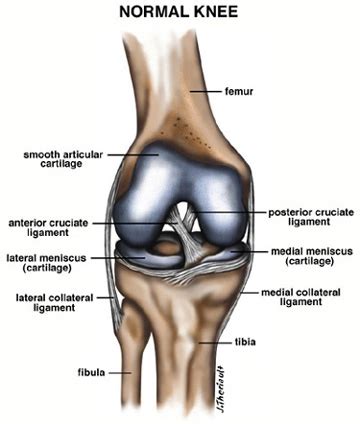 Can Partial Acl Tear Heal On Its Own - Robert Lopez Kapsels