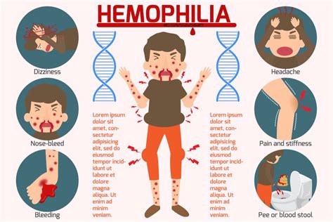 Hemophilia - Causes, Symptoms, Treatment - Solution Parmacy