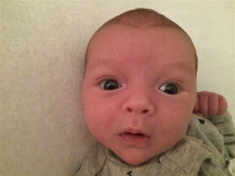 Is his fontanel swollen? | BabyCenter