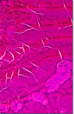 Molecular Expressions Microscopy Primer: Specialized Microscopy Techniques - Phase Contrast ...