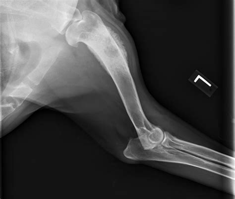 Dog Bone Cancer X Ray Pictures - CancerWalls