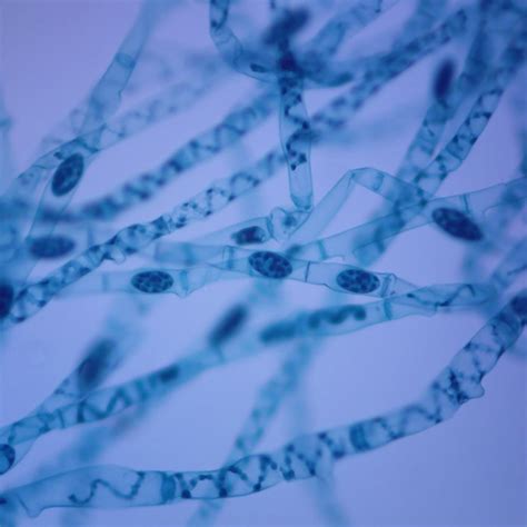 Spirogyra Lateral Conjugation, w.m. Microscope Slide | Carolina.com