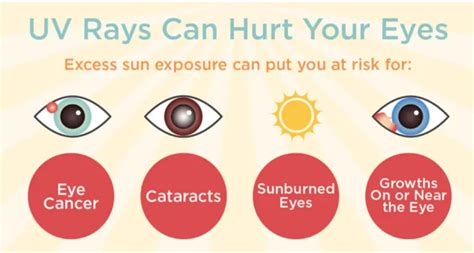 July is UV Eye Safety Month | Department of Ophthalmology