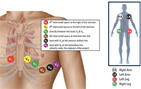 Demystifying the 12 Lead ECG! - Nurse Your Own Way