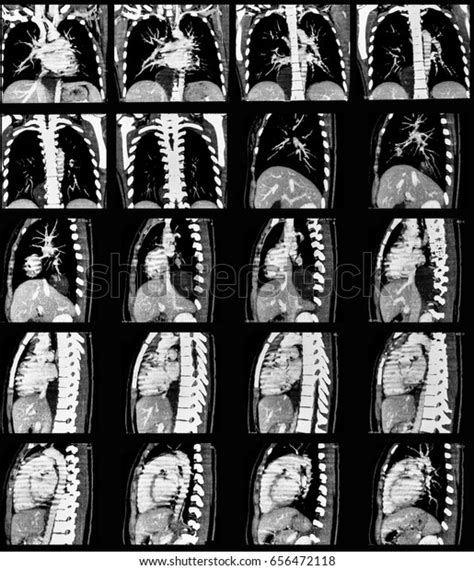 866 Abdomen Mri Scan Images, Stock Photos, 3D objects, & Vectors | Shutterstock