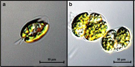 Cell morphology of T. chuii under autotrophic (a) and heterotrophic (b)... | Download Scientific ...