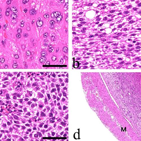 Histopathological findings. (a) Large epithelial-like decidual cells... | Download Scientific ...