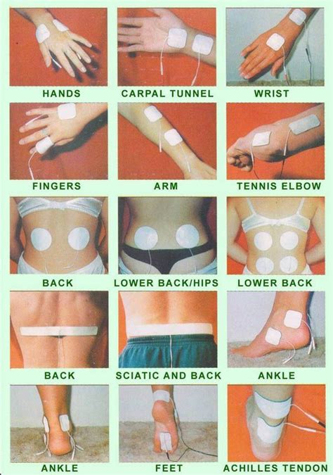 Tens Unit Placement Diagram