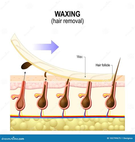 Hair removal. Waxing stock vector. Illustration of healthcare - 102799675