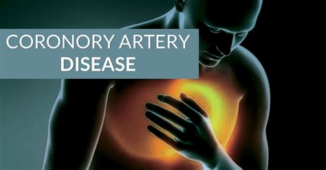 3 Treatment Approaches For Coronary Artery Disease – Marham