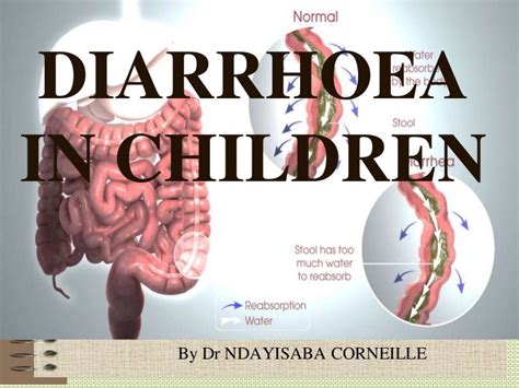 Diarrhoea in children