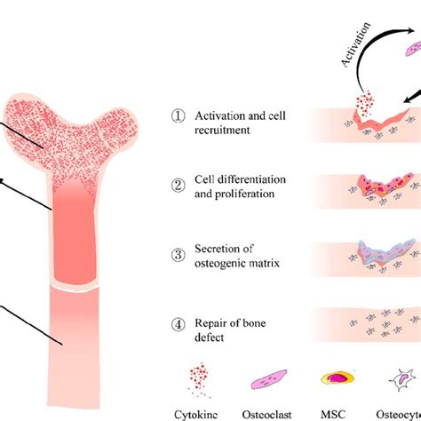 Schematic diagram of the structure of bone (left) and bone repair... | Download Scientific Diagram