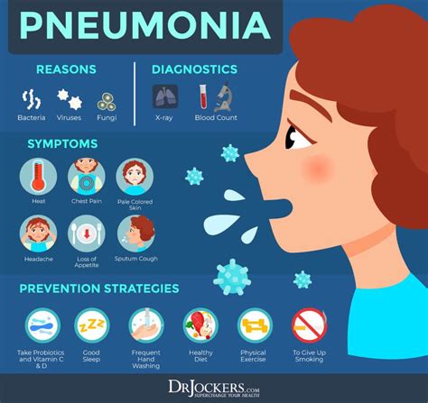 Pneumonia: Causes, Symptoms & Support Strategies - DrJockers.com | Pneumonia, Pneumonia symptoms ...