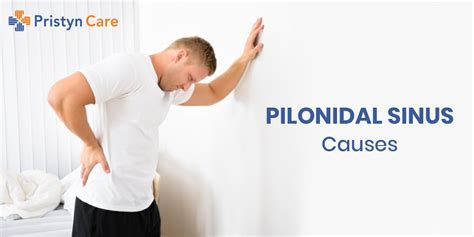 Pilonidal Sinus Causes - Pristyn Care