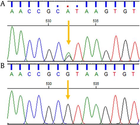 The Sanger sequencing electropherograms. Proband with heterozygous ...