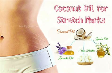 Top 27 Ways To Use Coconut Oil For Stretch Marks On Breasts During Pregnancy