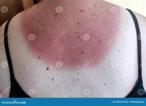 Burned Skin Leather Texture Royalty-Free Stock Photo | CartoonDealer ...