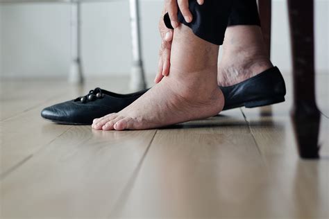 What Can Cause One Swollen Ankle Without Pain?