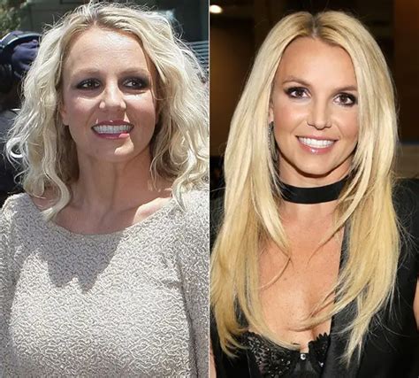 Britney Spears Plastic Surgery Before and After Botox Injections | Celebie