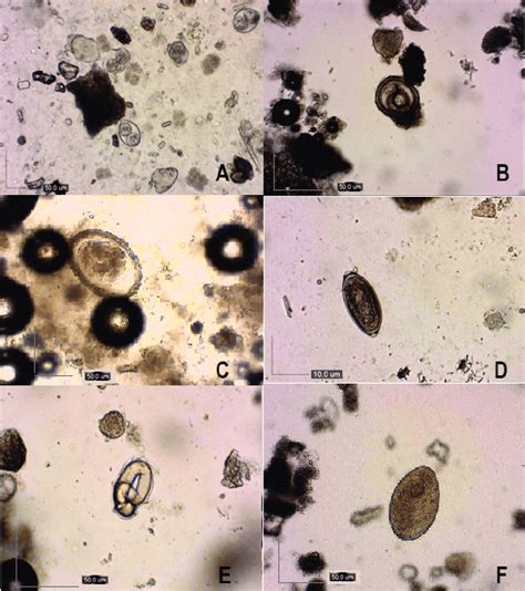 Parasitology diagnosis of soil samples. A) sporulated oocysts of... | Download Scientific Diagram