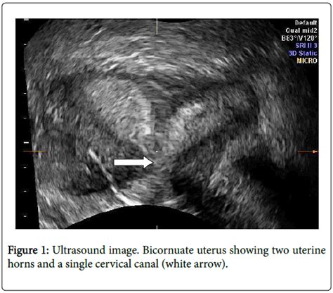 sexual-disorders-Ultrasound-image