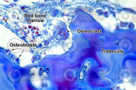 Mammal. Spongy osseous tissue. Femur. Transverse section. 500X - Spongy ...