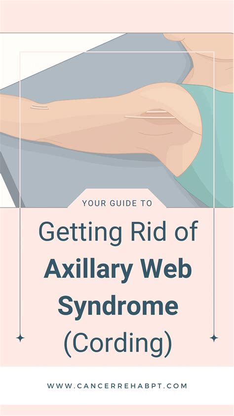 Cancer Rehab PT — Your Guide to Getting Rid of Axillary Web Syndrome ...