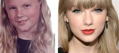 Taylor Swift Plastic Surgery: Nose job, Boob Job, Butt Implant