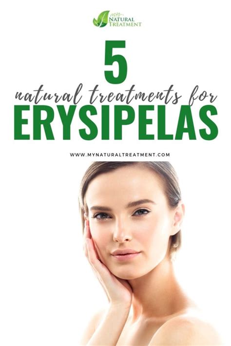 5 Natural Treatments for Erysipelas | Erysipelas Remedies