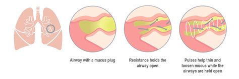 12 Devices To Help Pulmonary Rehabilitation And COPD | Healthy Living Links