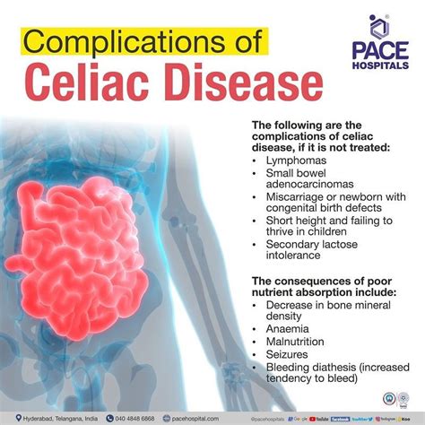 Celiac Disease - Symptoms, Causes, Risk Factors and Complications