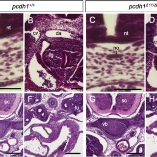 Tissues surrounding notochord of pcdh1 knockout mice. (A-H) HE staining... | Download Scientific ...