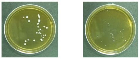 Growth of Lactobacillus acidophilus in culture plates. | Open-i