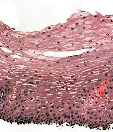 Stratified squamous epithelium - Wikipedia