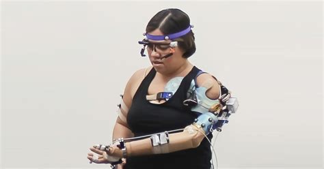 New bionic arm is incredibly close to the real thing