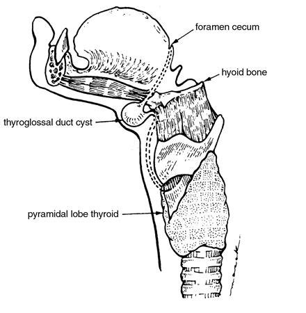 Thyroglossal Duct Cyst Histology