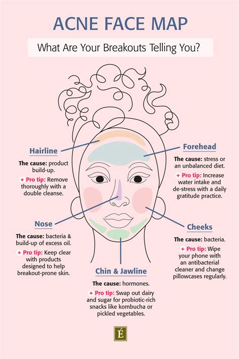 Zits Face Map: What Are Your Breakouts Telling You? - My WordPress